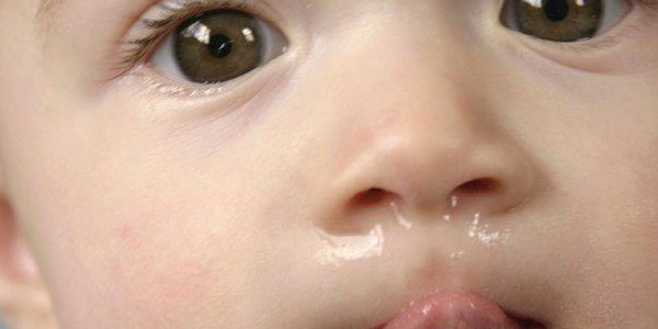 Причини за зголемена секреција од носот